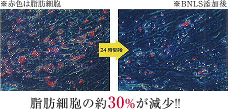 脂肪細胞の約30%が減少