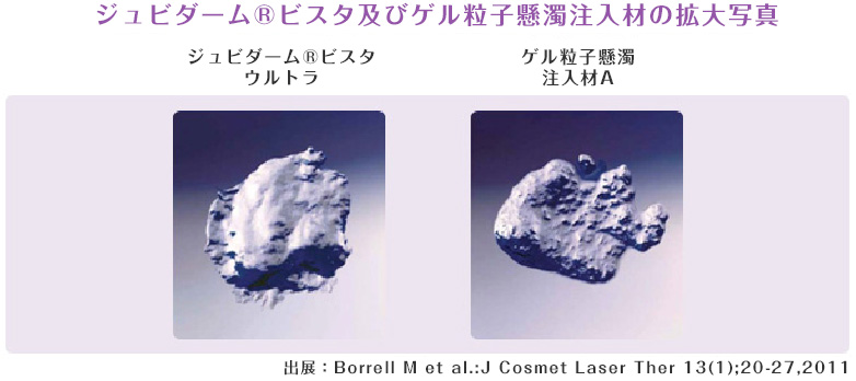 ジュビダームビスタ拡大写真