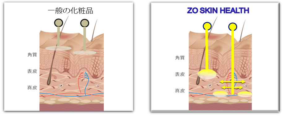 ゼオスキンヘルスの特徴