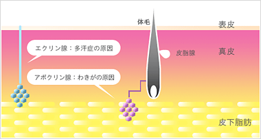 ミラドライノ特徴