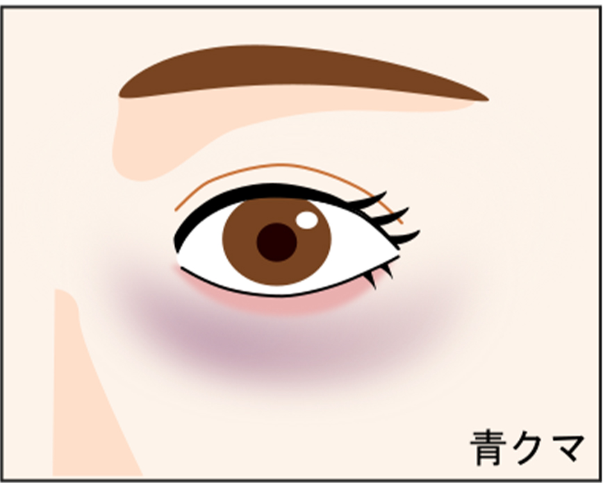 青クマ