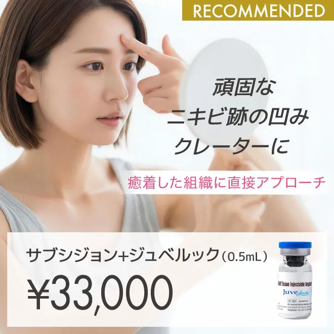 サブシジョン
