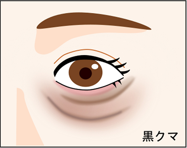 黒クマ