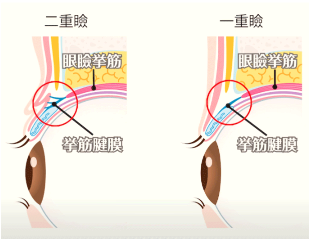 一重と二重の違い