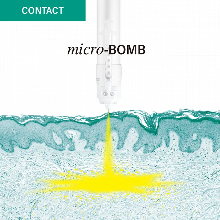 製剤と刺激によるコラーゲンのリモデリング