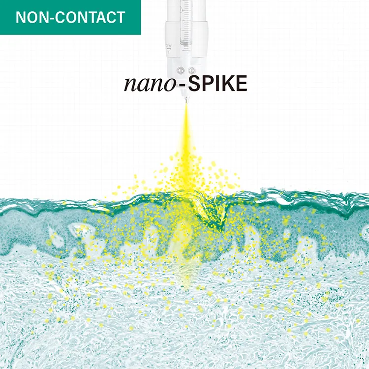 ニードルでは治療が難しい皮下深度0.2~0.3mをターゲット