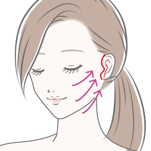 フェイスリフト