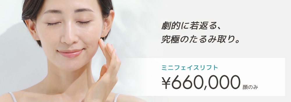 フェイスリフト