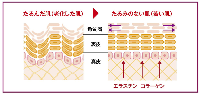 リフトアップ効果の仕組み