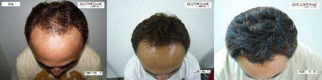 ドクターズヘア症例写真