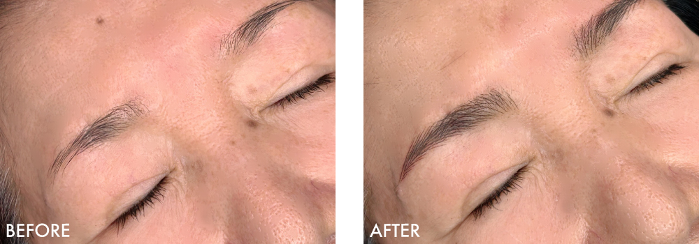 眉アートメイク