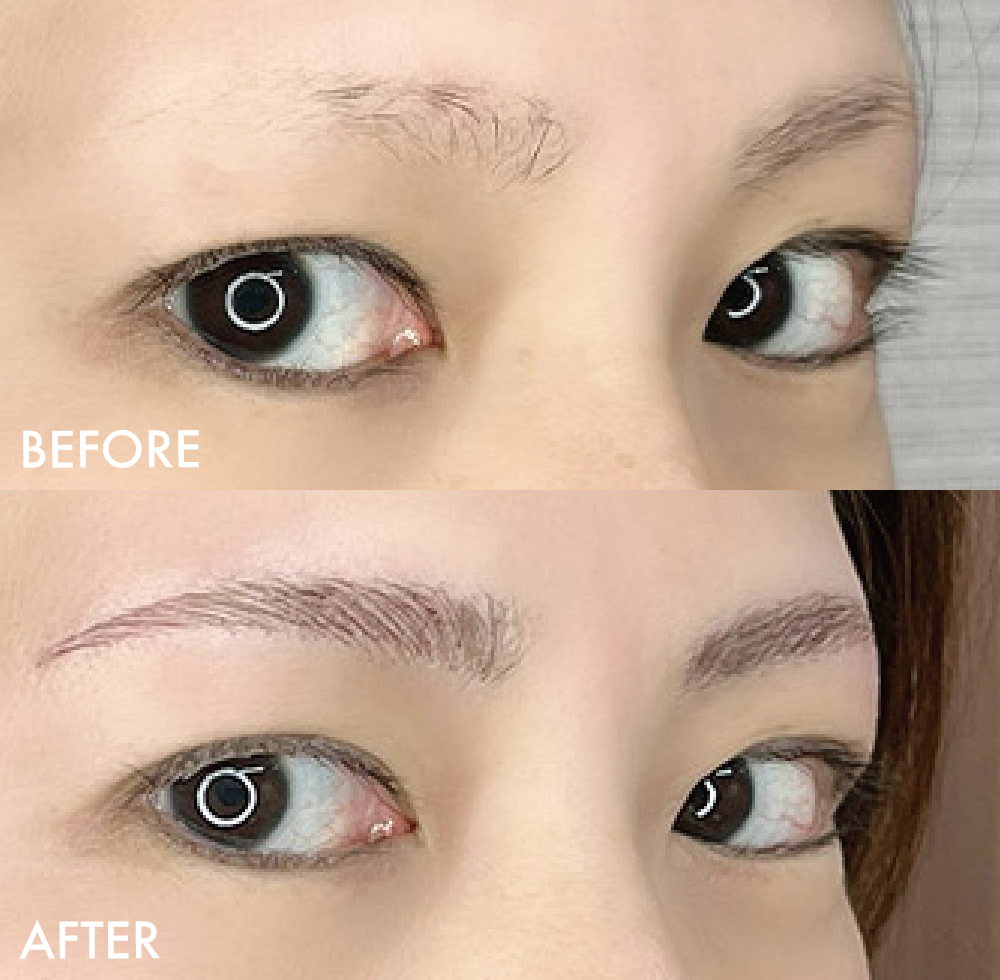 眉アートメイク