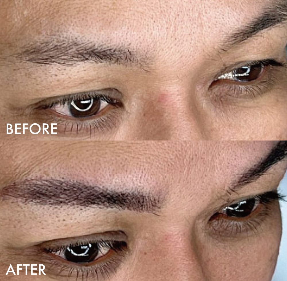 眉アートメイク