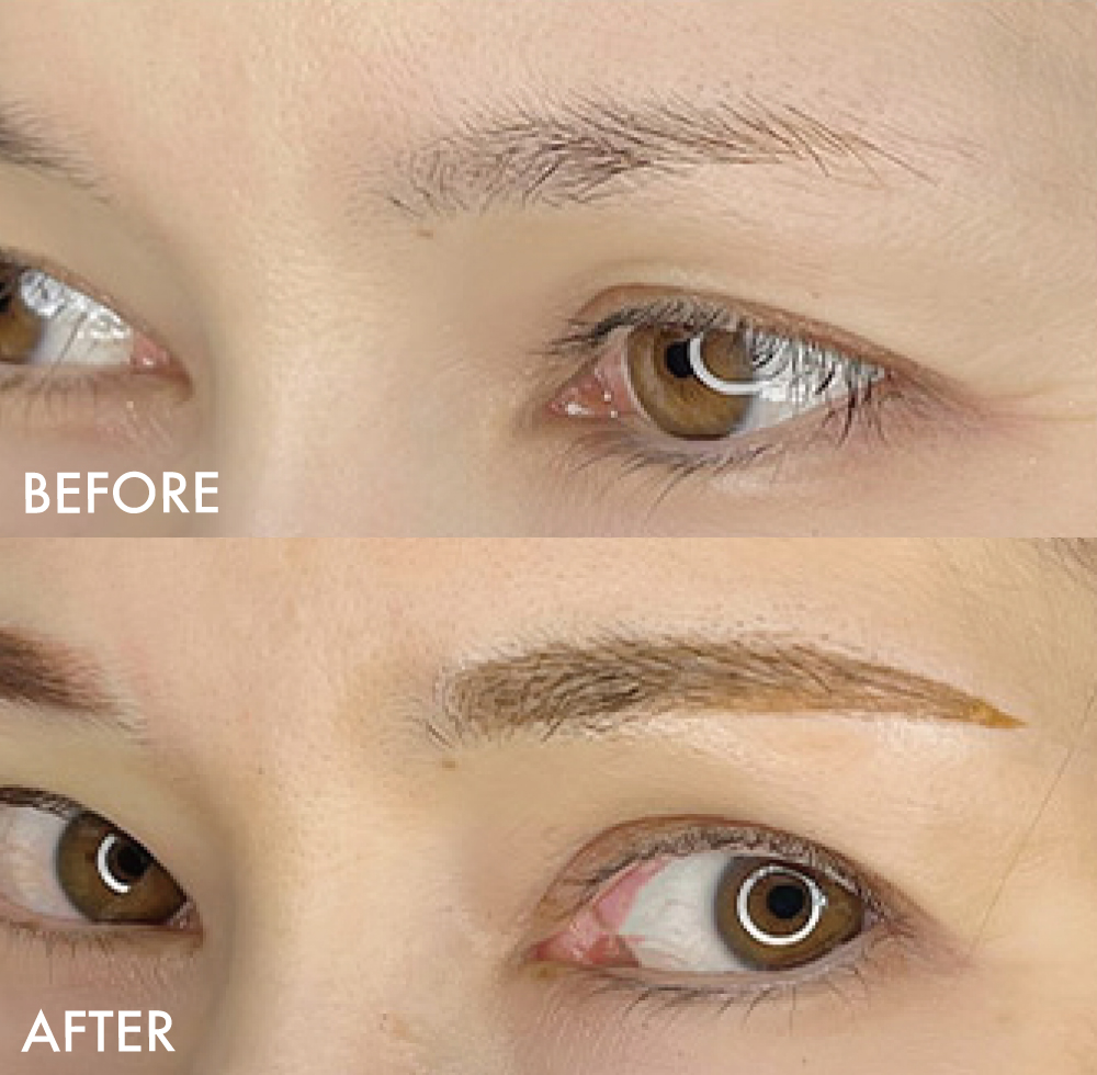 眉アートメイク