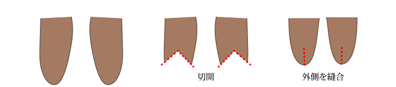 経過 小陰唇縮小