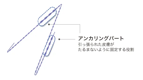 アンカリングパート